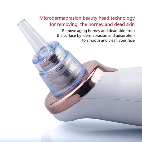 N1 Electric Blackhead Remover Pore Vacuum Suction Dermabrasion Face Cleaner - Image 11